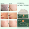 A cicatriz de limpeza erval orgânica natural da acne dos cuidados com a pele do creme de cara remove o tratamento